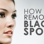 Fast Tricks to Remove Your Black Dots